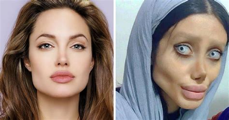 angelina jolie plastic surgery iran.